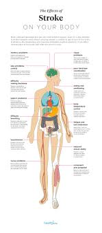 The Effects Of Stroke On The Body