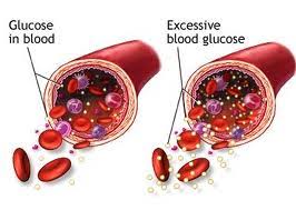 Low Blood Sugar Symptoms Blood Sugar Levels Chart What Is