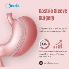 gastric sleeve surgery dallas tx