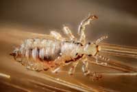 head lice management guidelines uc ipm