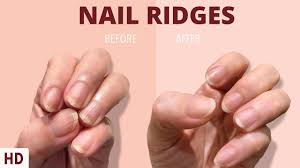 nail ridges the silent signaling your