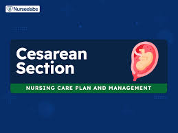 9 cesarean birth nursing care plans c