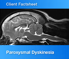 paralysis factsheet vet oracle