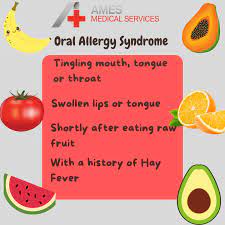 hay fever and allergy syndrome