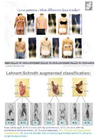 management of spinal deformities and