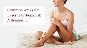 common areas for laser hair removal