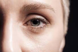 can eyelid surgery make your eyes bigger