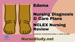 edema nursing diagnosis and care plan