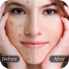 Don't know how to remove blemishes from photos? Face Blemish Remover Smooth Skin Beautify Face Apps On Google Play