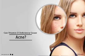 can vitamin d deficiency cause acne