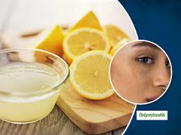 how to use lemon to remove pimples and