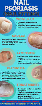 nail pitting causes symptoms home