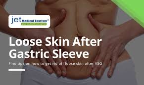 loose skin after gastric sleeve jet