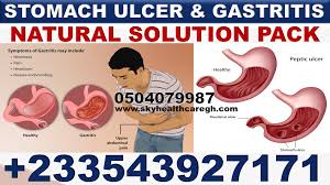 forever gastric ulcer treatment pack