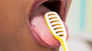 Ein gelber pickel auf der zunge kann eine herpesbläschenentzündung oder sogar herpes sein. Mundkrankheiten Sieben Fiese Leiden An Zunge Mundschleimhaut Und Zahnfleisch