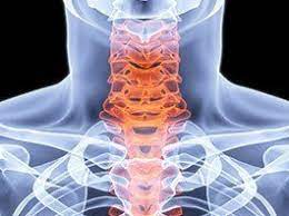 cervical spinal stenosis surgery