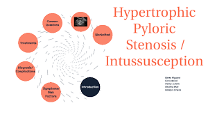 Hypertrophic Pyloric Stenosis Intussusception By Karen