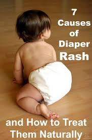 7 causes of diaper rash and how to