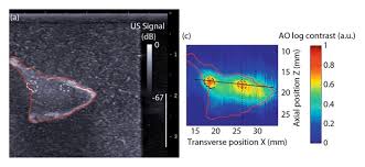 optic ultrasound imaging of ex vivo