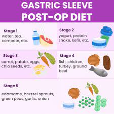 gastric sleeve post op t ses