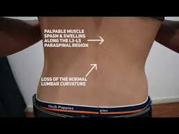 TNTOASP  Low Back Pain case study Part   Diagnostic Imaging Low Back Pain