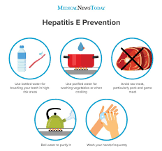 Hepatitis E Causes Symptoms And Treatment