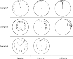 clock drawing test springerlink
