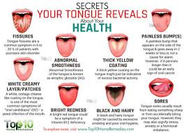 Find Out What Your Tongue Is Telling You Tongue Health