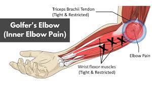 golfer s elbow a helpful guide for