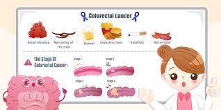 to colorectal cancer age is