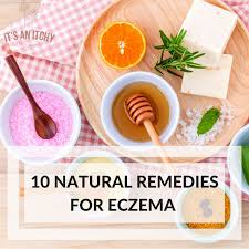10 natural home remes for eczema to