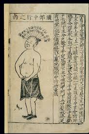 File Acupuncture Chart Midline Of The Head Chinese Woodcut