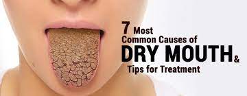 7 most common causes of dry mouth