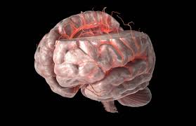 Cerebral stroke refers to a problem arising due to lack of oxygen supply to the brain. Middle Cerebral Artery Stroke Causes And Symptoms