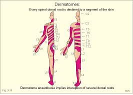 Dermatomes Mycerebellarstrokerecovery