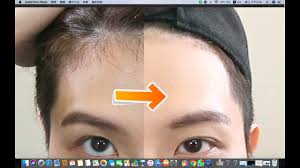 There are no similarities of the growth of hair. How To Tidy Up Hairline Remove Baby Hair Issac Yiu Youtube