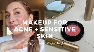 acne rosacea or sensitive skin