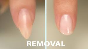 acrylic nail removal you
