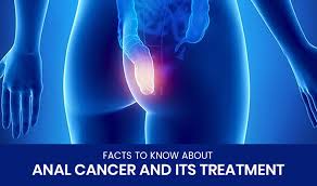 The cost of cancer treatments has increased dramatically. Anal Cancer Treatment Cost In India Anan Cancer Medsurge India