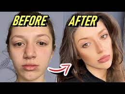 judy d plastic surgeon vs makeup artist