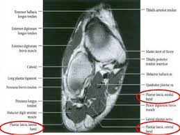Medial plantar muscles of the foot: Foot Radiological Anatomy Shorouk Zaki