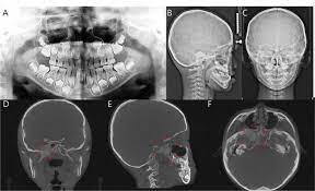 2d radiographs in detecting cbct based