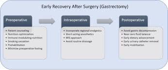 major gastrectomy for cancer
