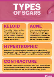 how to get rid of scars naturally 8