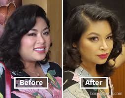 face changes after weight loss