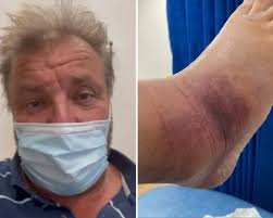 Home under the hammer host and former i'm a celebrity star martin roberts was rushed to a&e over the weekend. Dc Smcyp383 3m