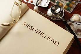 If you are seeking out a mesothelioma lawyer, there are several questions you may want to ask. Is Mesothelioma A Painful Death Pintas Mullins Law Firm