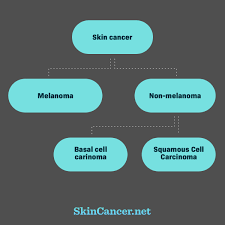 Skin Cancer Types Skincancer Net
