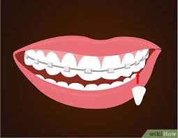 The nail should be roughly the size of your canine teeth, which are the most common place for vampire fangs. How To Make Vampire Fangs If You Have Braces 12 Steps