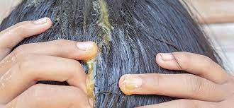 healthy hair do eggs aid in hair growth